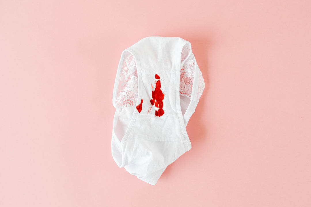 Intermenstrual bleeding, blood-mixed discharge and spotting